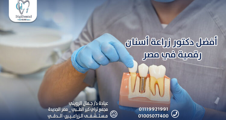 أفضل دكتور زراعة أسنان رقمية في مصر