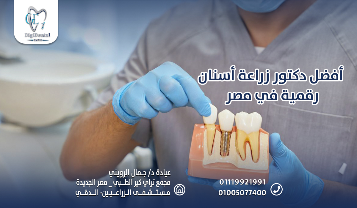 أفضل دكتور زراعة أسنان رقمية في مصر
