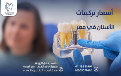 أسعار تركيبات الأسنان في مصر
