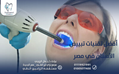 أفضل تقنيات تبييض الأسنان في مصر