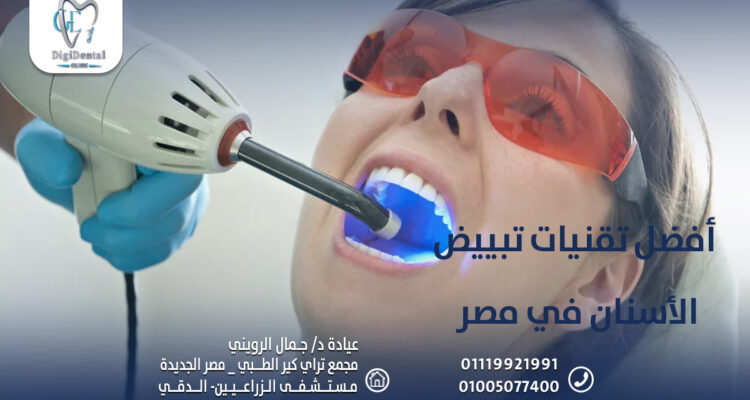 أفضل تقنيات تبييض الأسنان في مصر