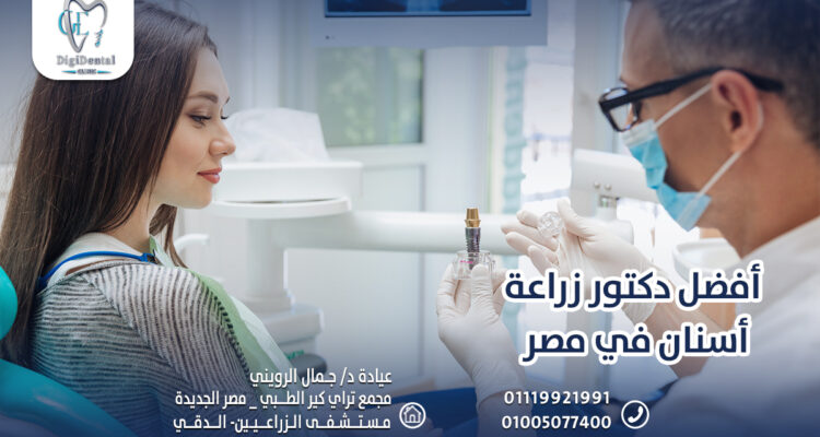 أفضل دكتور زراعة أسنان في مصر