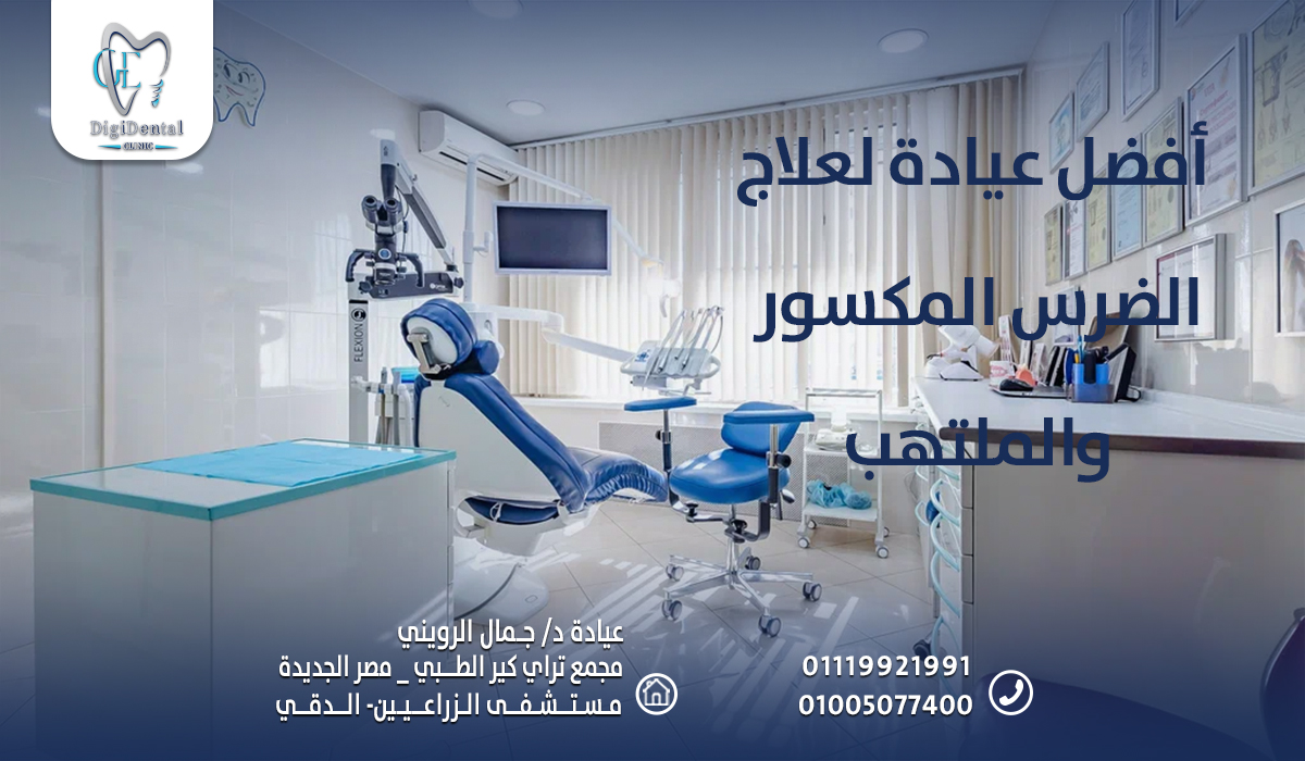 أفضل عيادة لعلاج الضرس المكسور والملتهب