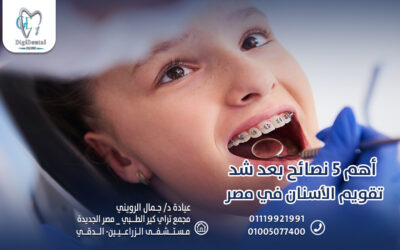 أهم 5 نصائح بعد شد تقويم الأسنان في مصر