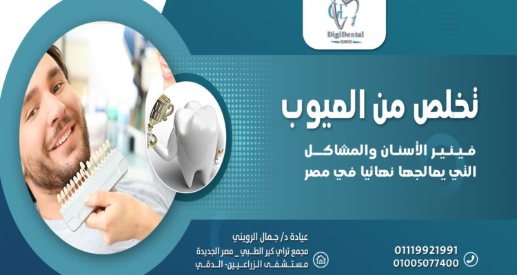 تخلص من العيوب فينير الأسنان والمشاكل التي يعالجها نهائيًا في مصر