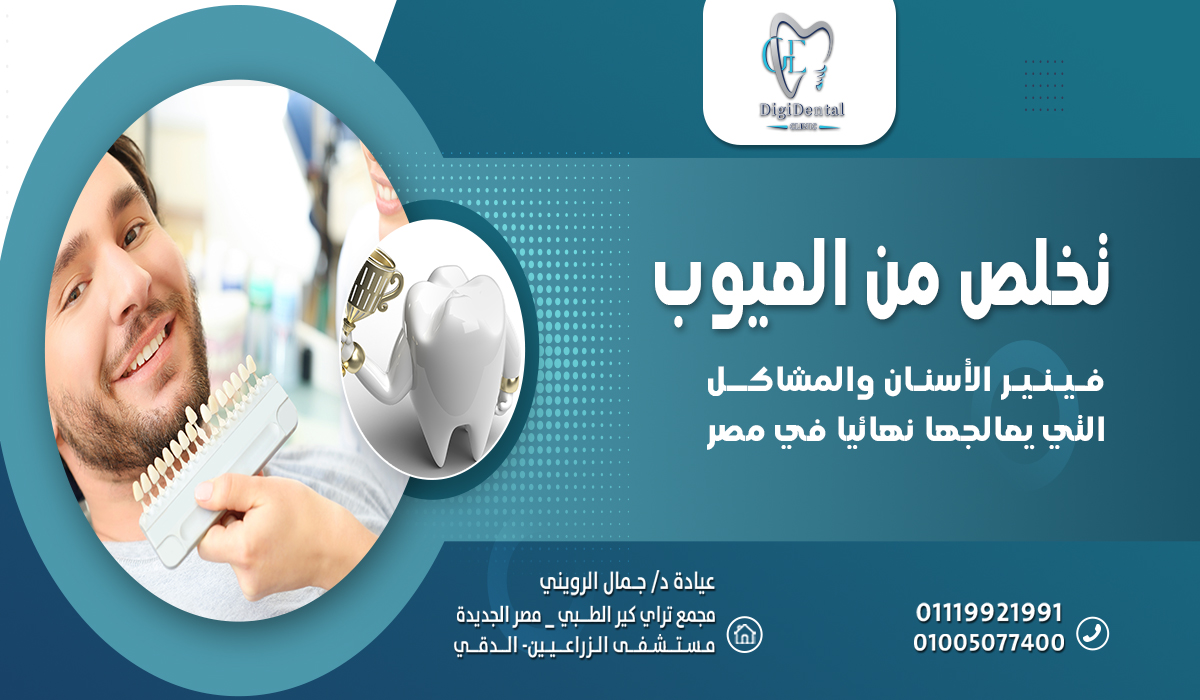 تخلص من العيوب فينير الأسنان والمشاكل التي يعالجها نهائيًا في مصر