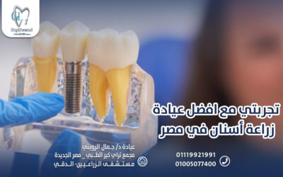 تجربتي مع افضل عيادة زراعة أسنان في مصر