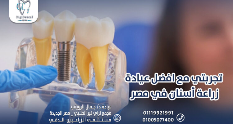 تجربتي مع افضل عيادة زراعة أسنان في مصر