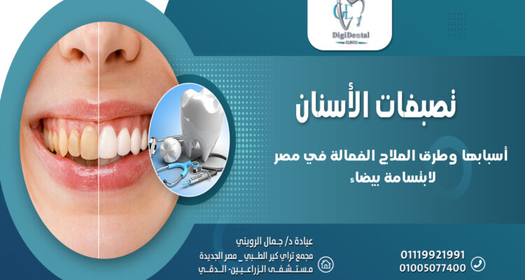 تصبغات الأسنان وأسبابها وطرق العلاج الفعالة في مصر لابتسامة بيضاء