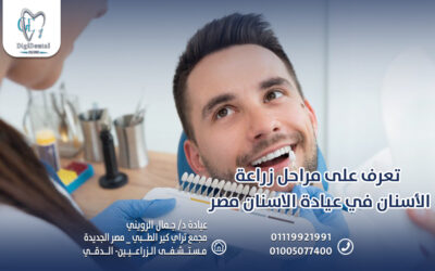 تعرف على مراحل زراعة الأسنان في عيادة الاسنان مصر