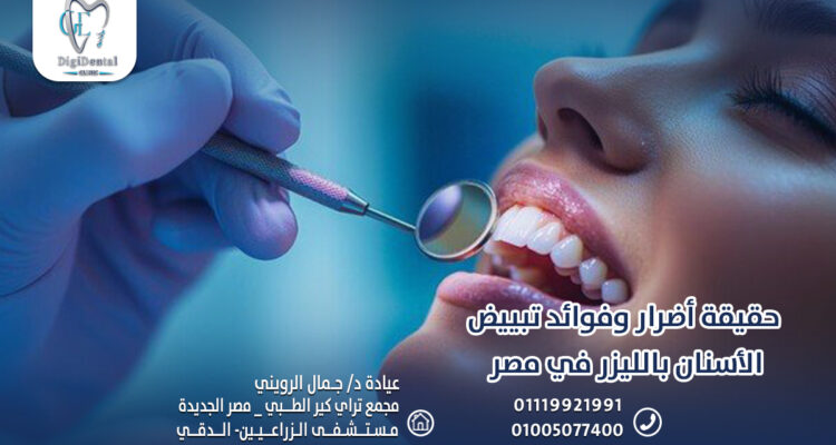 حقيقة أضرار وفوائد تبييض الأسنان بالليزر في مصر
