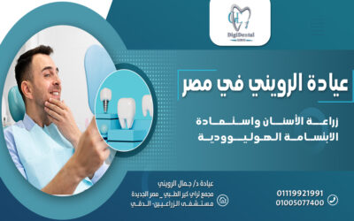 زراعة الأسنان واستعادة الابتسامة الهوليوودية في عيادة الرويني في مصر