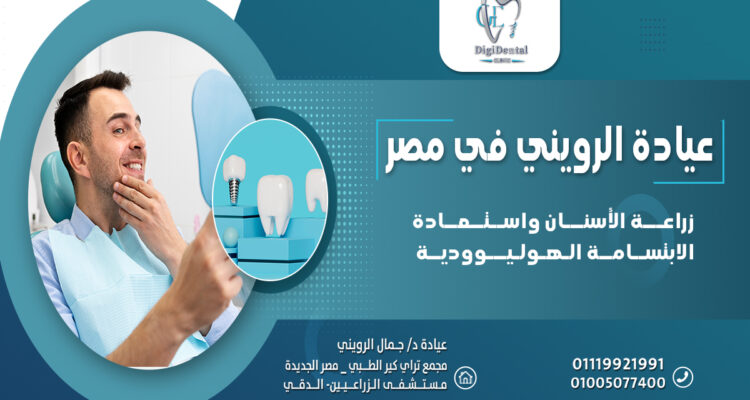 زراعة الأسنان واستعادة الابتسامة الهوليوودية في عيادة الرويني في مصر