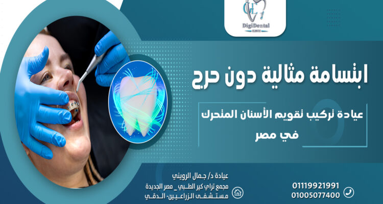 عيادة تركيب تقويم الأسنان المتحرك في مصر: ابتسامة مثالية دون حرج