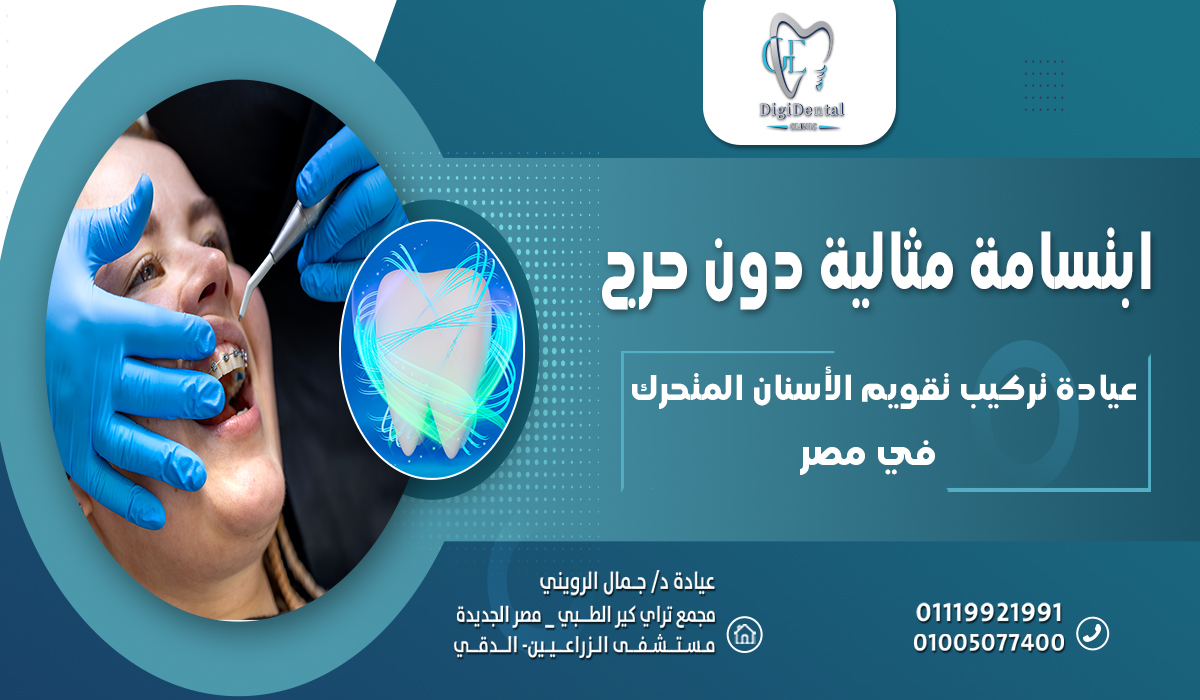 عيادة تركيب تقويم الأسنان المتحرك في مصر: ابتسامة مثالية دون حرج