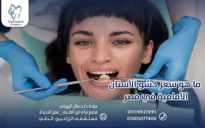 ما هو سعر حشو الأسنان الأمامية في مصر