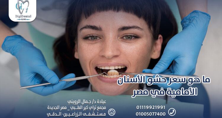 ما هو سعر حشو الأسنان الأمامية في مصر