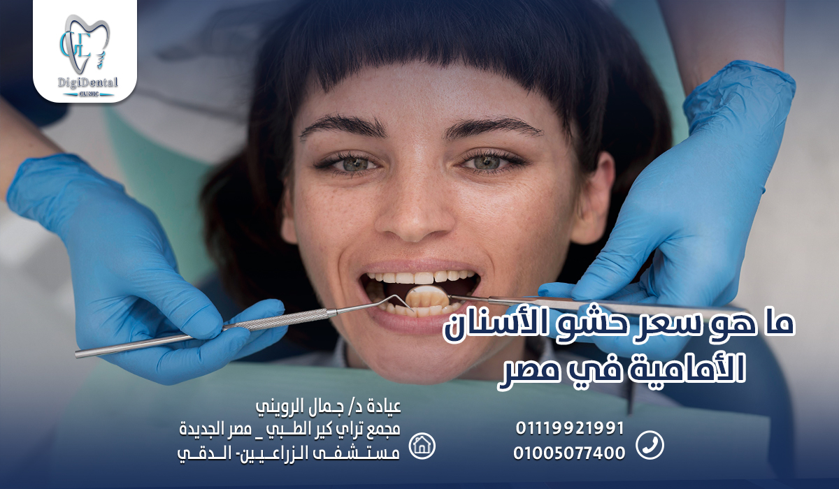 ما هو سعر حشو الأسنان الأمامية في مصر