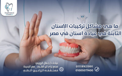 ما هي مشاكل تركيبات الاسنان الثابتة في عيادة اسنان في مصر