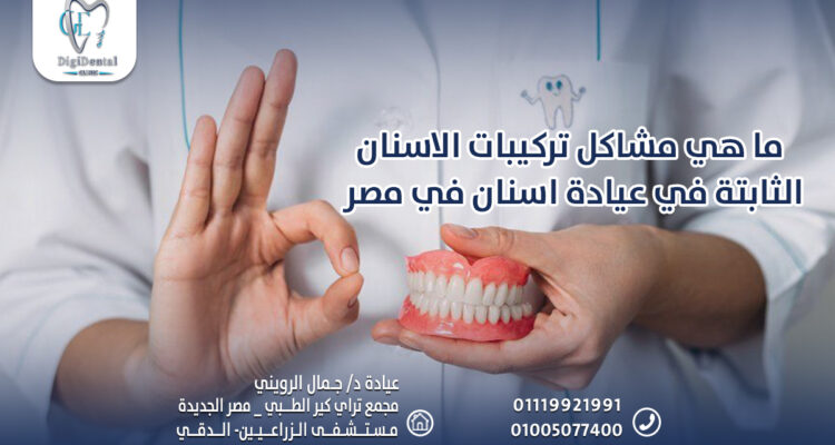 ما هي مشاكل تركيبات الاسنان الثابتة في عيادة اسنان في مصر