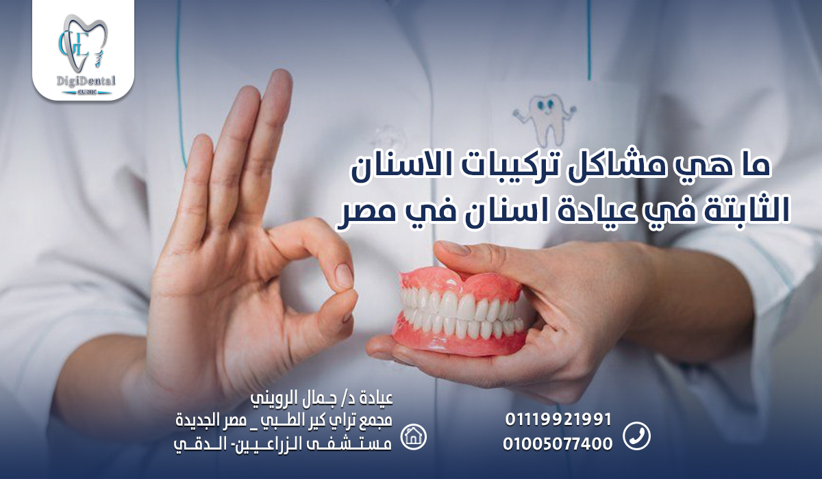 ما هي مشاكل تركيبات الاسنان الثابتة في عيادة اسنان في مصر