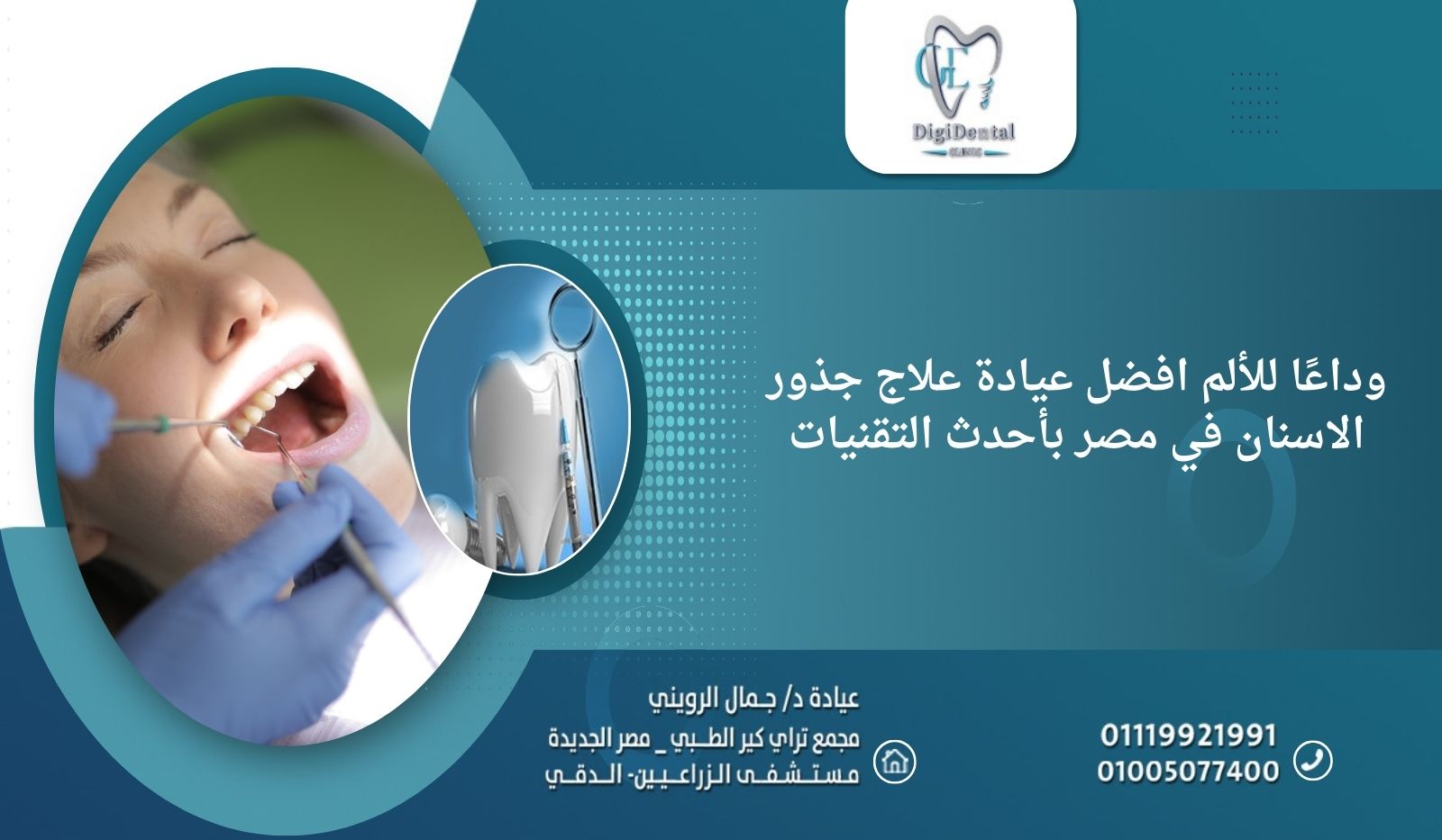 وداعًا للألم: افضل عيادة علاج جذور الاسنان في مصر بأحدث التقنيات