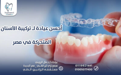 أحسن عيادة لـ تركيبة الأسنان المتحركة في مصر
