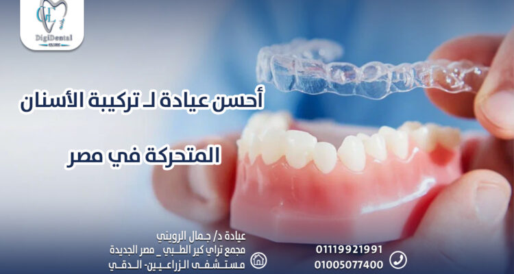 أحسن عيادة لـ تركيبة الأسنان المتحركة في مصر