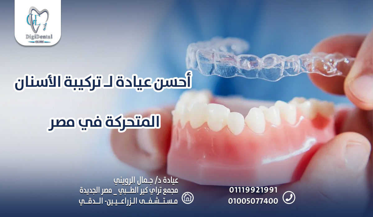 أحسن عيادة لـ تركيبة الأسنان المتحركة في مصر