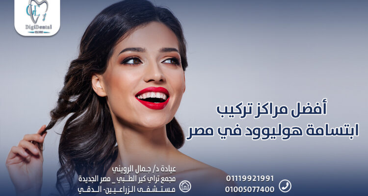 أفضل مراكز تركيب ابتسامة هوليوود في مصر
