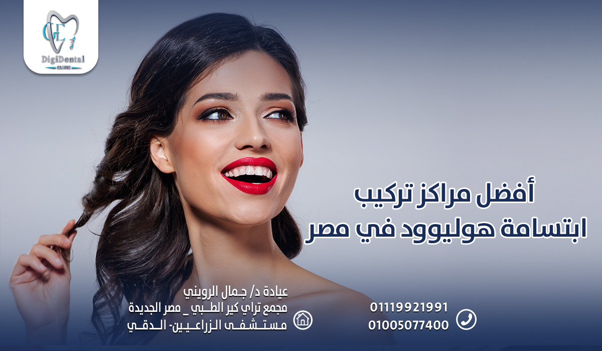 أفضل مراكز تركيب ابتسامة هوليوود في مصر