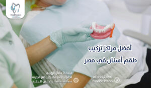 أفضل مراكز تركيب طقم أسنان في مصر
