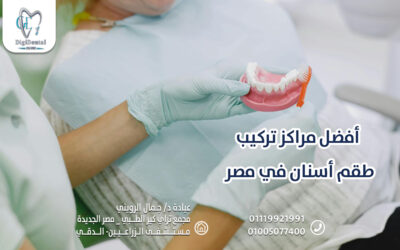 أفضل مراكز تركيب طقم أسنان في مصر