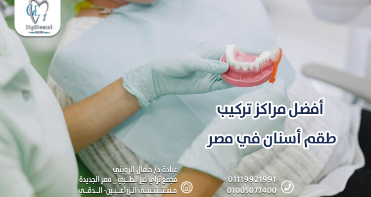 أفضل مراكز تركيب طقم أسنان في مصر