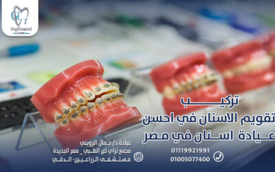 تركيب تقويم الاسنان في احسن عيادة اسنان في مصر