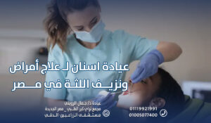 عيادة اسنان لـ علاج أمراض ونزيف اللثة في مصر