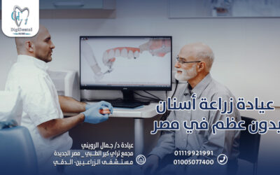 عيادة زراعة أسنان بدون عظم في مصر
