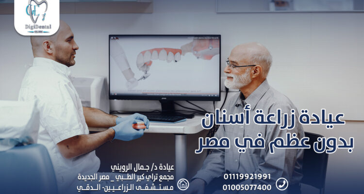 عيادة زراعة أسنان بدون عظم في مصر