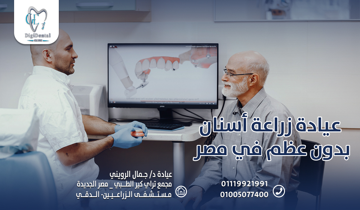 عيادة زراعة أسنان بدون عظم في مصر