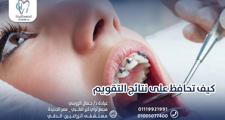 كيف تحافظ على نتائج التقويم