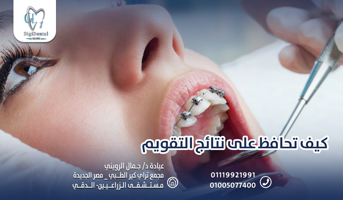 كيف تحافظ على نتائج التقويم