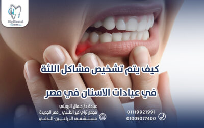 كيف يتم تشخيص مشاكل اللثة في عيادات الاسنان في مصر