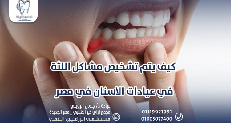 كيف يتم تشخيص مشاكل اللثة في عيادات الاسنان في مصر