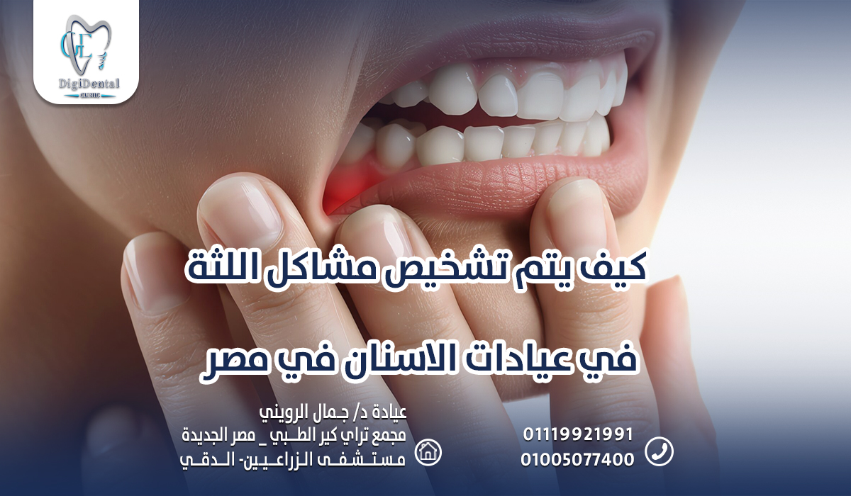 كيف يتم تشخيص مشاكل اللثة في عيادات الاسنان في مصر